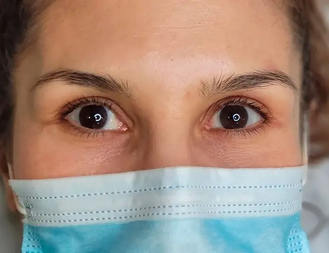 Cejas y pestañas: antes
