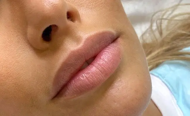 Labios efecto nude: antes