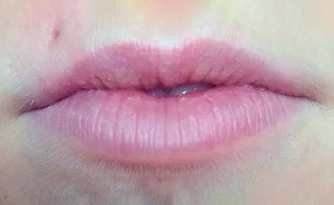 Micropigmentación de labios: antes