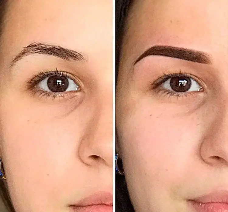 Antes y después de microshading